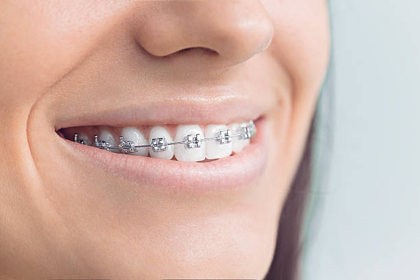 Best Tooth Extraction  in Aspermont, TX